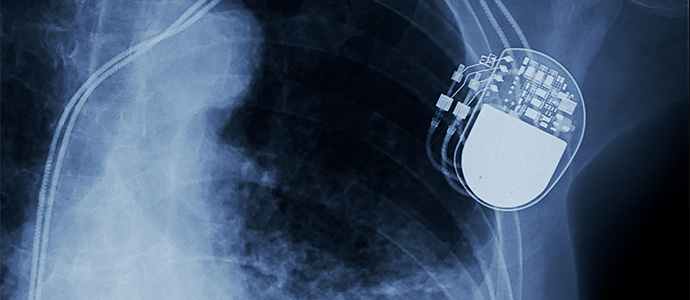 14_MemoryMedical_0196917462747039aab96c88d68676ca