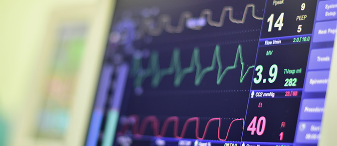 15_EKG_01969174627378e4a1300eb6b462a226